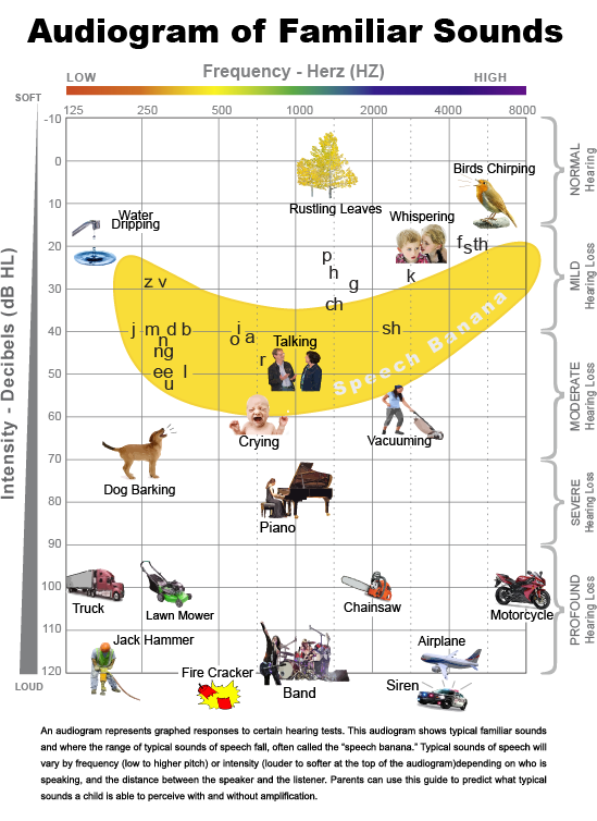 Chart showing where sound land on an audiogram